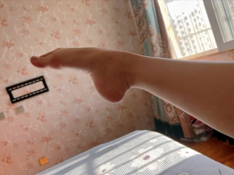 Are High Arches Good For Ballet