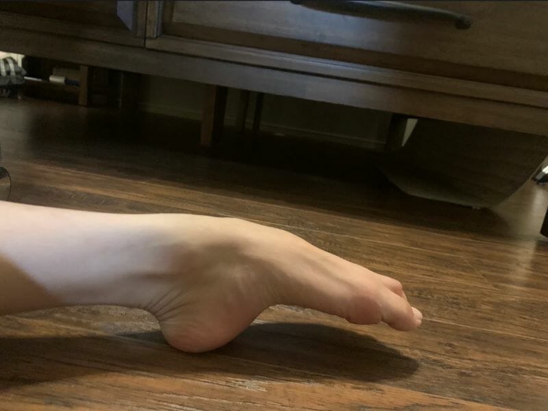 Do Ballet Dancers Have Ugly Feet