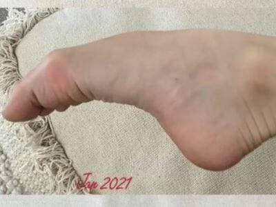 Does Ballet Ruin Your Feet? (Explained for Beginners) – Dance Gaily